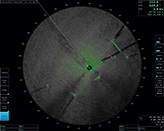 Navigation + oil radar picture. Green echoes from navigation radar, the rest is oil radar picture.